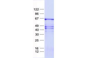 Validation with Western Blot