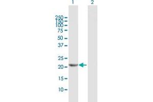 Western Blot analysis of RPE expression in transfected 293T cell line by RPE MaxPab polyclonal antibody. (RPE anticorps  (AA 1-228))