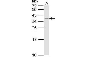 WB Image Sample (30 ug of whole cell lysate) A: H1299 12% SDS PAGE antibody diluted at 1:1000 (HLA-DR anticorps  (Center))