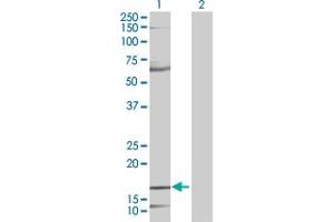 Lane 1: MDK transfected lysate ( 15. (MDK 293T Cell Transient Overexpression Lysate(Denatured))