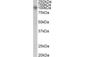 Western Blotting (WB) image for anti-ADAM Metallopeptidase Domain 8 (ADAM8) antibody (ABIN5911617) (ADAM8 anticorps)
