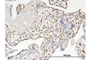 Immunoperoxidase of monoclonal antibody to RUNX2 on formalin-fixed paraffin-embedded human placenta. (RUNX2 anticorps  (AA 251-350))