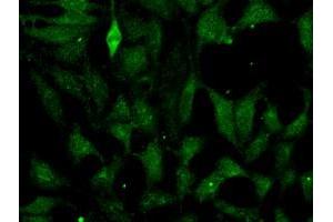 Image no. 4 for anti-Fumarate Hydratase (FH) antibody (ABIN1498269) (FH anticorps)