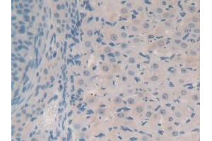 Detection of SYN1 in Mouse Ovary Tissue using Polyclonal Antibody to Synapsin I (SYN1)