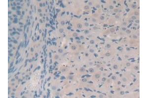 Detection of SYN1 in Mouse Ovary Tissue using Polyclonal Antibody to Synapsin I (SYN1) (SYN1 anticorps  (AA 113-420))