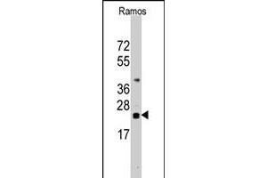 Western blot analysis of CD247 polyclonal antibody  in Ramos cell line lysates (35 ug/lane).