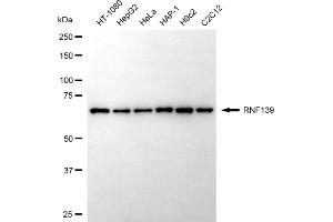 Western blotting analysis using RNF139 antibody (ABIN7800242).