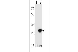 Western blot analysis of TPI1 (arrow) using rabbit polyclonal TPI1 Antibody (N-term) (ABIN389457 and ABIN2839524). (TPI1 anticorps  (N-Term))
