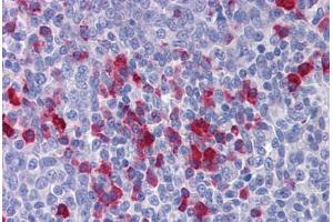 Human Tonsil: Formalin-Fixed, Paraffin-Embedded (FFPE)