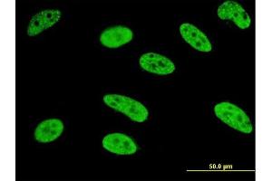 Immunofluorescence of monoclonal antibody to MEF2A on HeLa cell. (MEF2A anticorps  (AA 71-170))