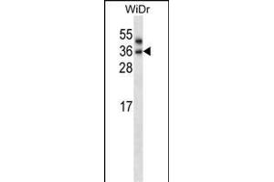 PNPLA4 Antibody (C-term) (ABIN657892 and ABIN2846844) western blot analysis in WiDr cell line lysates (35 μg/lane).