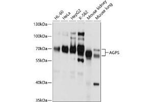 Western blot analysis of extracts of various cell lines, using AGPS antibody (ABIN6129641, ABIN6136644, ABIN6136645 and ABIN6214756) at 1:1000 dilution. (AGPS anticorps  (AA 379-658))