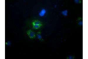 Anti-CALCOCO2 mouse monoclonal antibody (ABIN2453920) immunofluorescent staining of COS7 cells transiently transfected by pCMV6-ENTRY CALCOCO2 (RC203843). (CALCOCO2 anticorps)