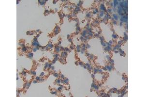 Used in DAB staining on fromalin fixed paraffin- embedded lung tissue (GADD34 anticorps  (Regulatory Subunit 15A))