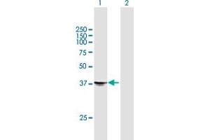 Western Blot analysis of STX18 expression in transfected 293T cell line by STX18 MaxPab polyclonal antibody. (Syntaxin 18 anticorps  (AA 1-335))