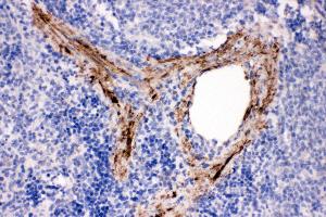 Anti-ADAM19 antibody, IHC(P) IHC(P): Rat Spleen Tissue (ADAM19 anticorps  (N-Term))
