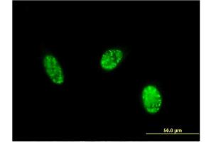 Immunofluorescence of monoclonal antibody to EXOSC1 on HeLa cell.