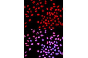 Immunofluorescence analysis of U2OS cells using IKZF1 antibody (ABIN5970949). (IKZF1 anticorps)
