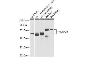 Western blot analysis of extracts of various cell lines using ADRA2B Polyclonal Antibody at dilution of 1:1000. (ADRA2B anticorps)
