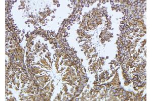 ABIN6276964 at 1/100 staining Mouse testis tissue by IHC-P. (GPX4 anticorps  (C-Term))