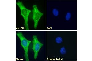 ABIN6391361 Immunofluorescence analysis of paraformaldehyde fixed HeLa cells, permeabilized with 0. (Sonic Hedgehog anticorps  (C-Term))