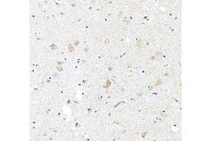 IHC analysis of ASIC2 using anti-ASIC2 antibody (ABIN7601023).