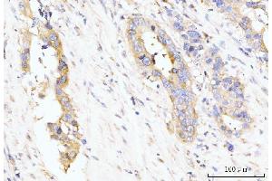 IHC analysis of LARP4B using anti-LARP4B antibody (ABIN7600865).