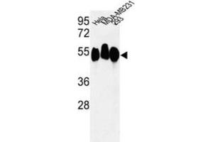 Western Blotting (WB) image for anti-Retinoblastoma Binding Protein 7 (RBBP7) antibody (ABIN3003931)
