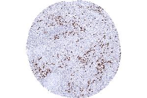 Spleen S100A12 immunostaining is seen in granulocytes of mainly the red pulp.