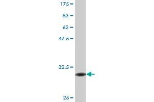 Western Blot detection against Immunogen (30.