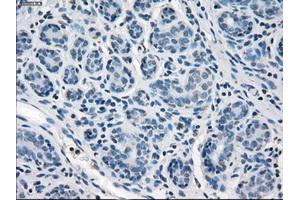 Immunohistochemical staining of paraffin-embedded breast tissue using anti-SLC2A5 mouse monoclonal antibody. (SLC2A5 anticorps)