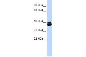 WB Suggested Anti-OTP Antibody Titration:  0. (OTP anticorps  (N-Term))