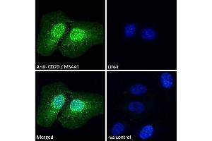 ABIN570905 Immunofluorescence analysis of paraformaldehyde fixed U2OS cells, permeabilized with 0.