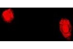 Immunofluorescent analysis of TPP2 staining in U2OS cells.