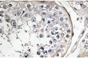 Image no. 1 for anti-Phosphoinositide 3 Kinase, p85 alpha (PI3K p85a) antibody (ABIN317803) (PIK3R1 anticorps)