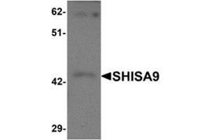 Western blot analysis of SHISA9 in rat brain tissue lysate with SHISA9 antibody at 1 μg/ml.
