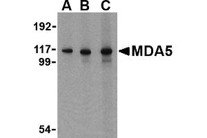 Western blot analysis of MDA5 in Daudi cell lysate with MDA5 antibody at (A) 1, (B) 2 and (C) 4 µg/mL. (IFIH1 anticorps  (C-Term))
