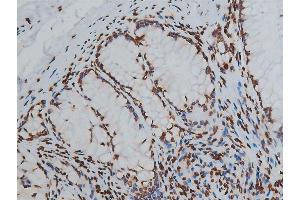 ABIN6254904 and ABIN6267568 at 1/200 staining human colon tissue sections by IHC-P. (Histone 3 anticorps  (H3K9ac))