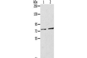 Western Blot analysis of A172 cells and Mouse liver tissue using ECE2 Polyclonal Antibody at dilution of 1/350 (ECE2 anticorps)