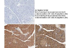 Immunohistochemistry with anti-IL-6 antibody showing cytoplasmic IL-6 staining in mouse pancreas exocrine and endocrine sections with islets of Langerhans at 10x and 20x (B & C).