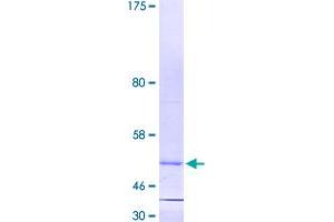 Image no. 1 for Retinoic Acid Receptor Responder (Tazarotene Induced) 1 (RARRES1) (AA 1-228) protein (GST tag) (ABIN1317447)