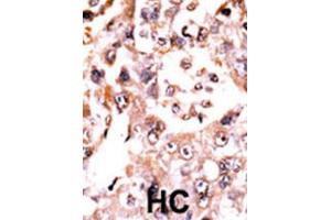 Immunohistochemistry (IHC) image for anti-Dual Specificity Phosphatase 3 (DUSP3) antibody (ABIN3003774) (Dual Specificity Phosphatase 3 (DUSP3) anticorps)