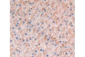 Used in DAB staining on fromalin fixed paraffin- embedded Kidney tissue