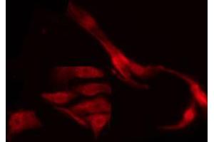 ABIN6267291 staining MDA-MB-435 by IF/ICC.