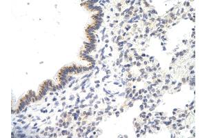 Rabbit Anti-VDAC3 antibody Catalog Number: ARP35180_P050  Paraffin Embedded Tissue: Human Lung cell  Cellular Data: Epithelial cells of renal tubule Antibody Concentration:  4. (VDAC3 anticorps  (N-Term))