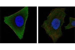 Confocal immunofluorescence analysis of Hela (left) and HepG2 (right) cells using JAK3 mouse mAb (green).