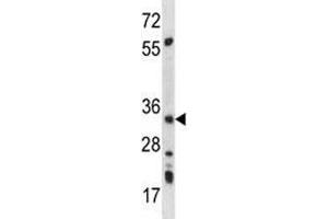 AMPK beta 2 antibody western blot analysis in mouse kidney tissue lysate (PRKAB2 anticorps  (AA 3-33))