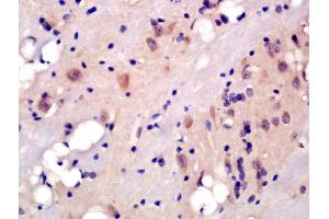 Formalin-fixed and paraffin embedded rat brain labeled with Rabbit Anti-5HT2A Receptor/SR-2A Polyclonal Antibody, Unconjugated (ABIN1386671) at 1:200 followed by conjugation to the secondary antibody and DAB staining (HTR2A anticorps  (AA 51-150))