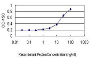 Detection limit for recombinant GST tagged SOX30 is approximately 1ng/ml as a capture antibody. (SOX30 anticorps  (AA 644-753))