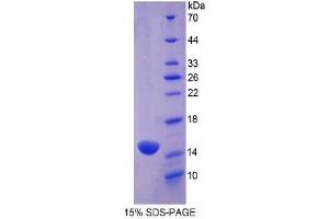 SDS-PAGE of Protein Standard from the Kit (Highly purified E.